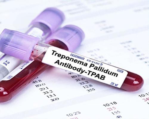 Xét nghiệm treponema pallidum