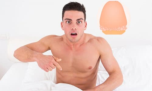 Bao quy đầu xuất hiện đốm trắng nguy hiểm không Bao quy đầu xuất hiện đốm trắng nguy hiểm không