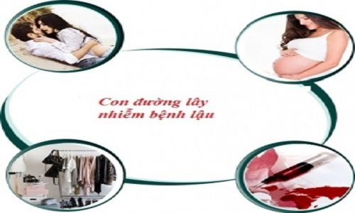 Bệnh lậu lây qua đường nào
