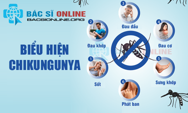 Dấu hiệu, biểu hiện bệnh Chikungunya