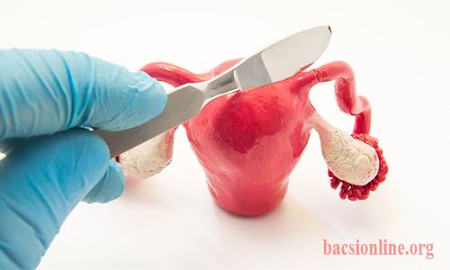 chữa tắc vòi trứng