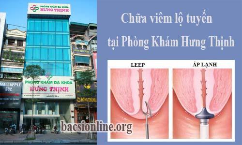 phác đồ điều trị viêm lộ tuyến tại Hưng Thịnh