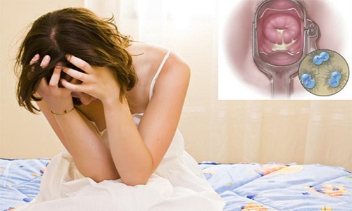 Dấu hiệu lậu mãn tính ở nữ giới