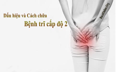 Dấu hiệu và cách chữa bệnh trĩ cấp độ 2 Dấu hiệu và cách chữa bệnh trĩ cấp độ 2