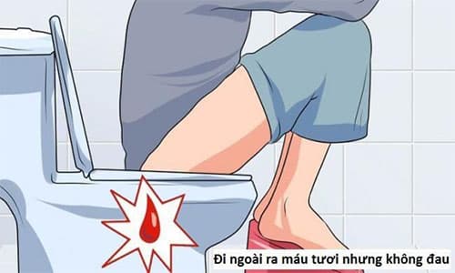 Đi đại tiện ra máu nhưng không đau là bệnh gì? Đi đại tiện ra máu nhưng không đau là bệnh gì?