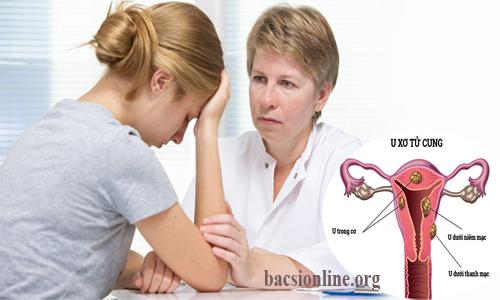 Mổ u xơ cổ tử cung ở đâu tốt