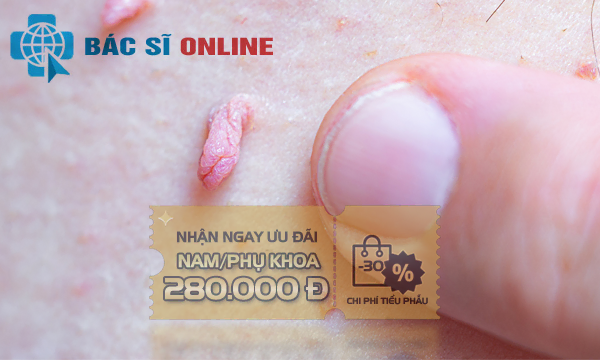Sùi mào gà tái phát 3 lần vẫn khỏi