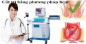 Cắt trĩ bằng phương pháp hcpt bao nhiêu tiền?