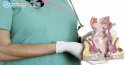 Chi phí phẫu thuật cắt búi trĩ hết bao nhiêu tiền?