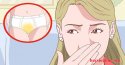 Đặt thuốc viêm âm đạo bị ra nhiều dịch vàng có sao không?