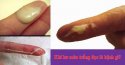 Cảnh giác với khí hư màu trắng đục ra nhiều