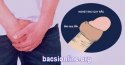 Nghẹt bao quy đầu: nguyên nhân, triệu chứng và cách chữa trị