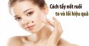 Cách tẩy nốt ruồi to và lồi hiệu quả không để lại sẹo