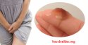 Ra khí hư màu nâu đỏ trước kỳ kinh có sao không?