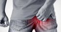 U nhú hậu môn có tự khỏi được không?