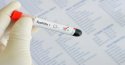 Xét nghiệm syphilis là gì và có nguy hiểm không? 