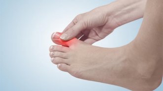 Bệnh cước là gì? Cách chữa bệnh cước vào mùa lạnh dứt điểm