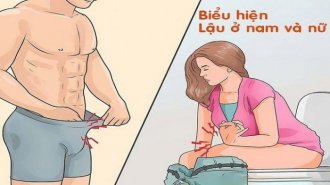 Biểu hiện lậu ở nam và nữ như nào? Cách chữa trị bệnh lậu ra sao?