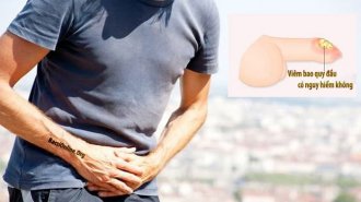 Bệnh viêm bao quy đầu có nguy hiểm không?