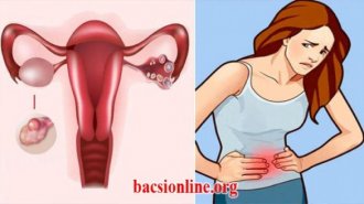 Bị u nang buồng trứng có thai được không?