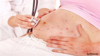Bà bầu bị zona thần kinh có ảnh hưởng đến thai nhi không?