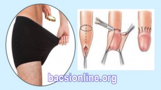 Cắt bao quy đầu là gì? Khi nào cần cắt bao quy đầu?