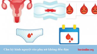 Chu kỳ kinh nguyệt không đều và những nguy hiểm tiềm ẩn