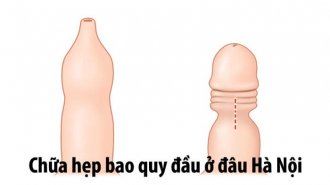 Chữa hẹp bao quy đầu ở đâu tại Hà Nội?