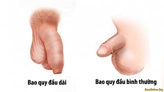Dài bao quy đầu là gì? Dài bao quy đầu có sao không?