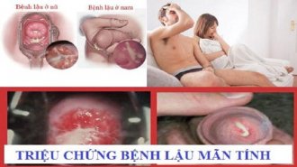Dấu hiệu bệnh lậu mãn tính ở nam giới và nữ giới