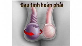 Đau tinh hoàn phải là bệnh gì? Có chữa được không?