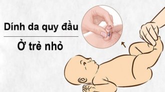 Dính bao quy đầu ở trẻ nhỏ có nguy hiểm không? Cách xử lý