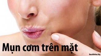 Hủy hoại nhan sắc nếu điều trị mụn cơm sai cách