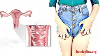 Viêm âm đạo do nấm nguyên nhân do đâu? [Chi Tiết Nhất]