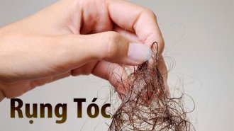 Rụng tóc nguyên nhân do đâu? Điều trị rụng tóc như thế nào?
