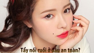 Địa chỉ tẩy nốt ruồi ở đâu an toàn ở Hà Nội