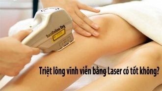 Triệt lông vĩnh viễn bằng laser có đau không? Có an toàn không?