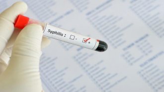 Xét nghiệm syphilis là gì và có nguy hiểm không? 