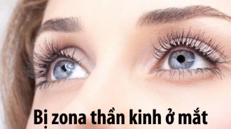 Suýt nữa bị mù khi chữa trị zona thần kinh ở mắt sai cách 