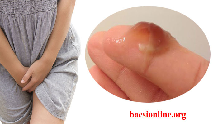 Kinh nguyệt màu đen: Nguyên nhân, biểu hiện, điều trị